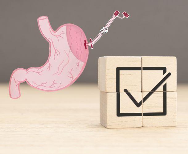 Vorteile PEG-Sonde Vorteile PEG-Sonde