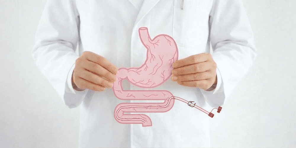 Perkutane Jejunalsonden (Dünndarmsonden) Perkutane Jejunalsonden (Dünndarmsonden)